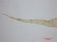 Aerobryopsis parisii (Card.) Broth. Collection Image, Figure 7, Total 10 Figures